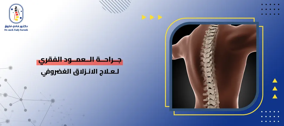 جراحة العمود الفقري لعلاج الانزلاق الغضروفي