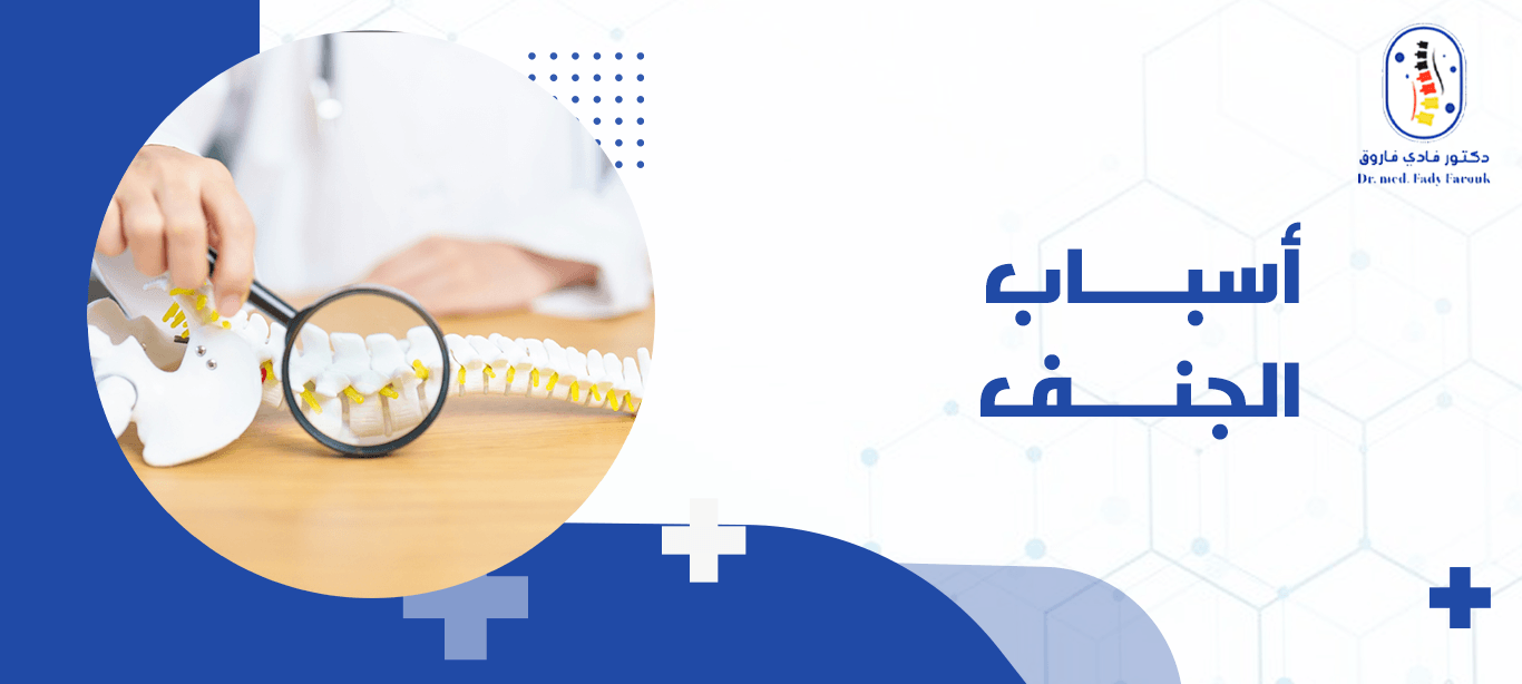 أسباب الجنف