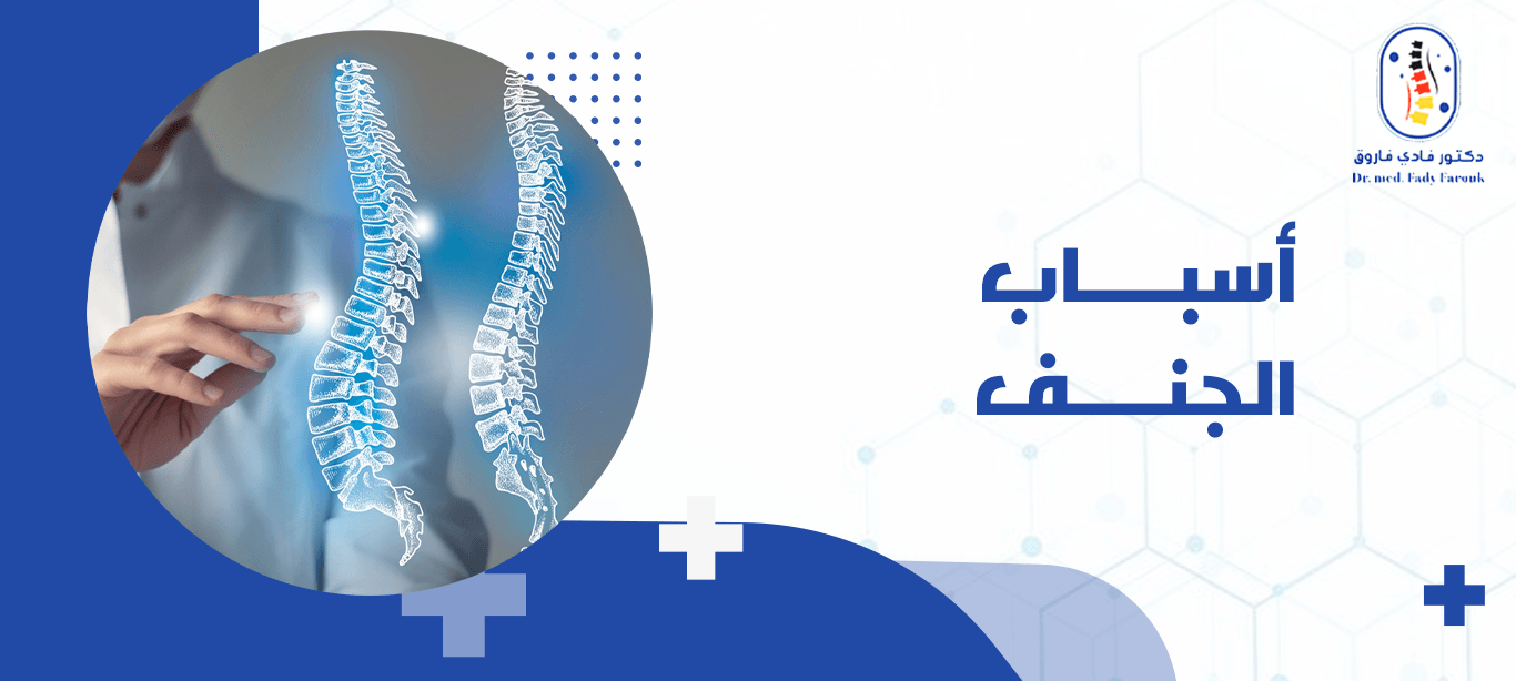 أسباب الجنف