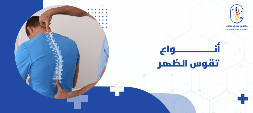 أنواع تقوس الظهر