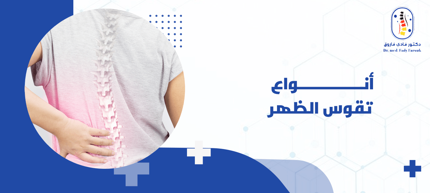 أنواع تقوس الظهر