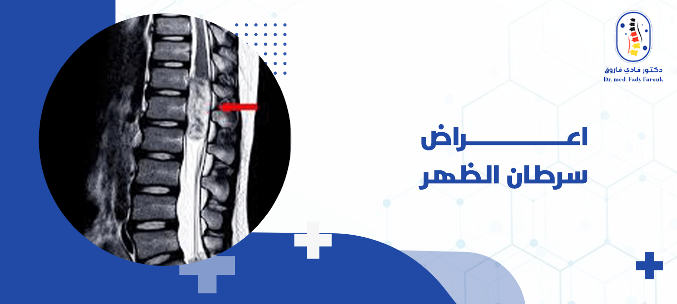 اعراض سرطان الظهر