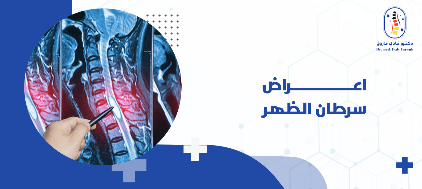 اعراض سرطان الظهر