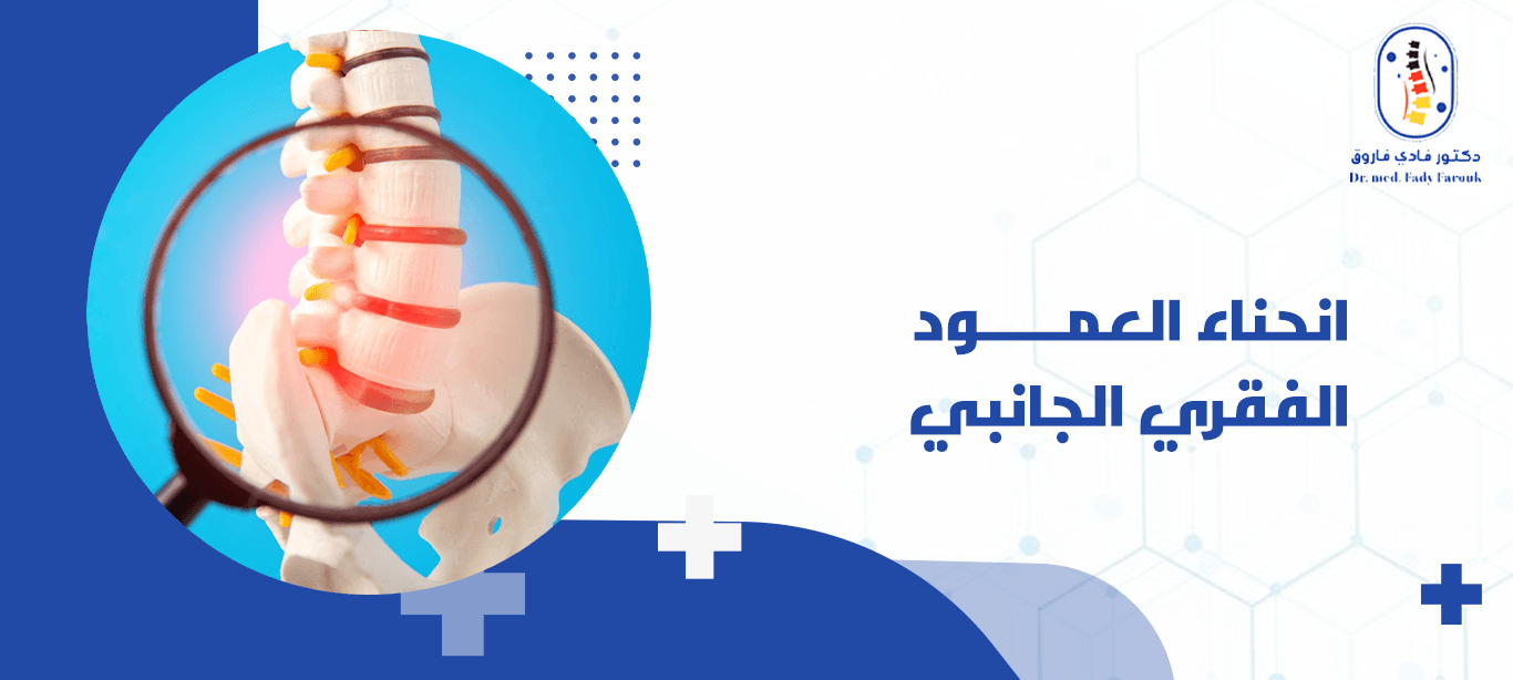 انحناء العمود الفقري الجانبي