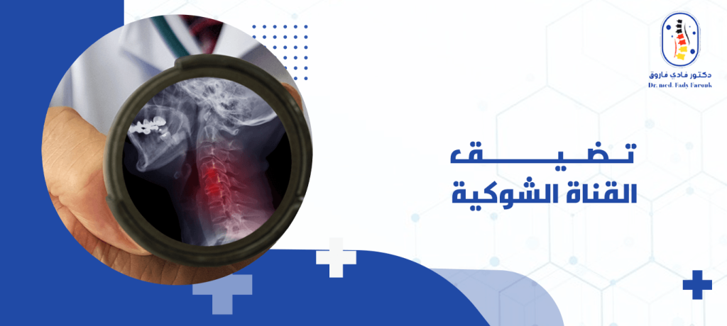 تضيق القناة الشوكية
