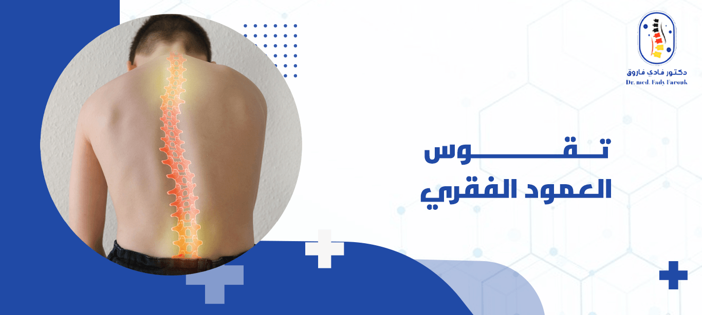 تقوس العمود الفقري