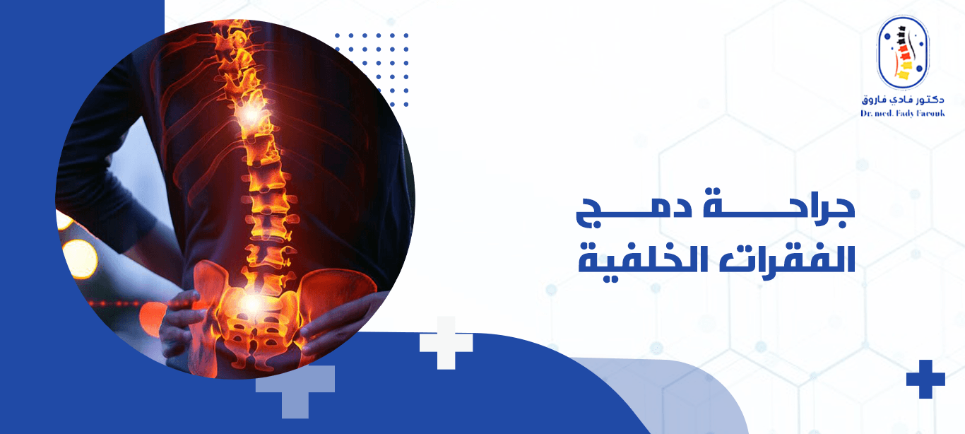 جراحة دمج الفقرات الخلفية