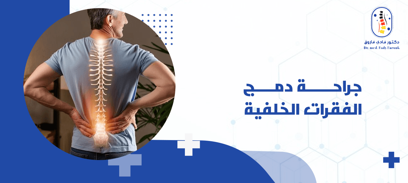 جراحة دمج الفقرات الخلفية