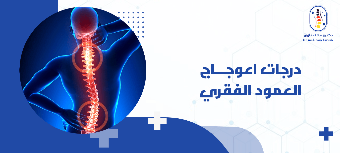 درجات اعوجاج العمود الفقري