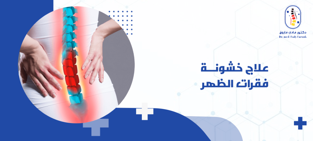 علاج خشونة فقرات الظهر