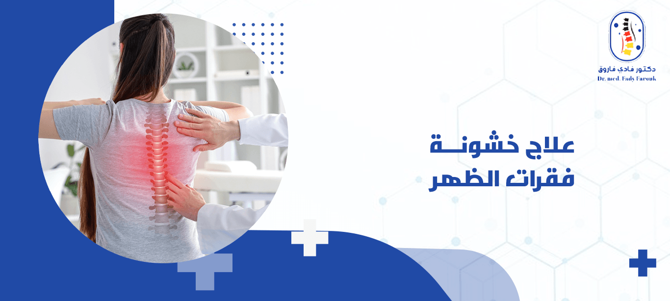 علاج خشونة فقرات الظهر