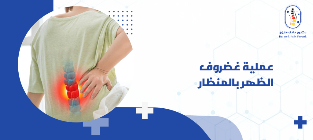 عملية غضروف الظهر بالمنظار