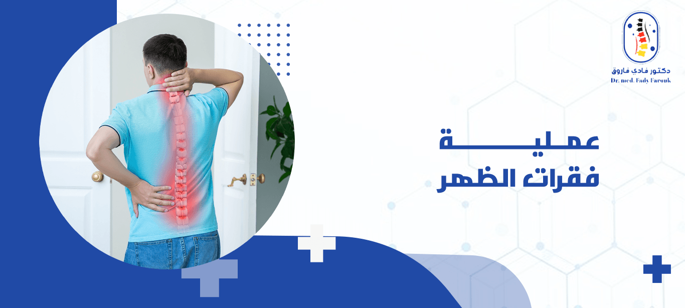 عملية فقرات الظهر
