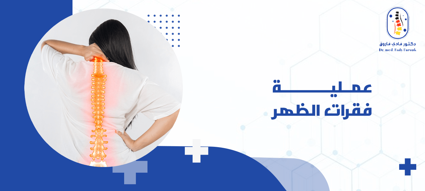 عملية فقرات الظهر