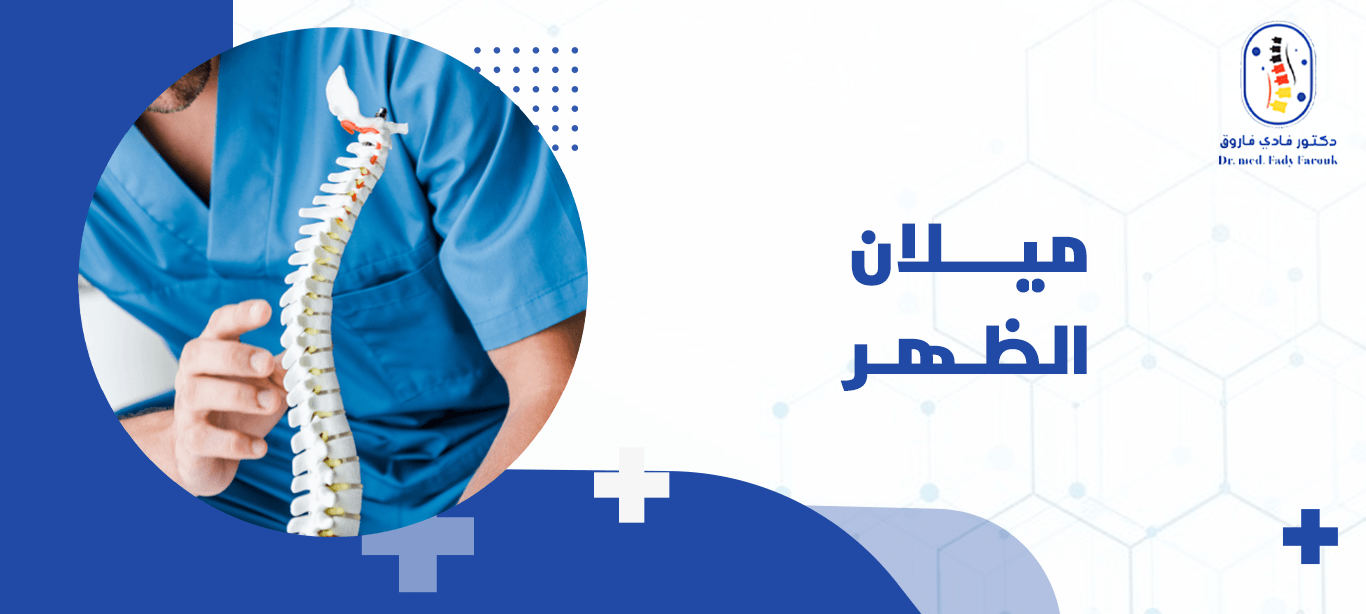 ميلان الظهر