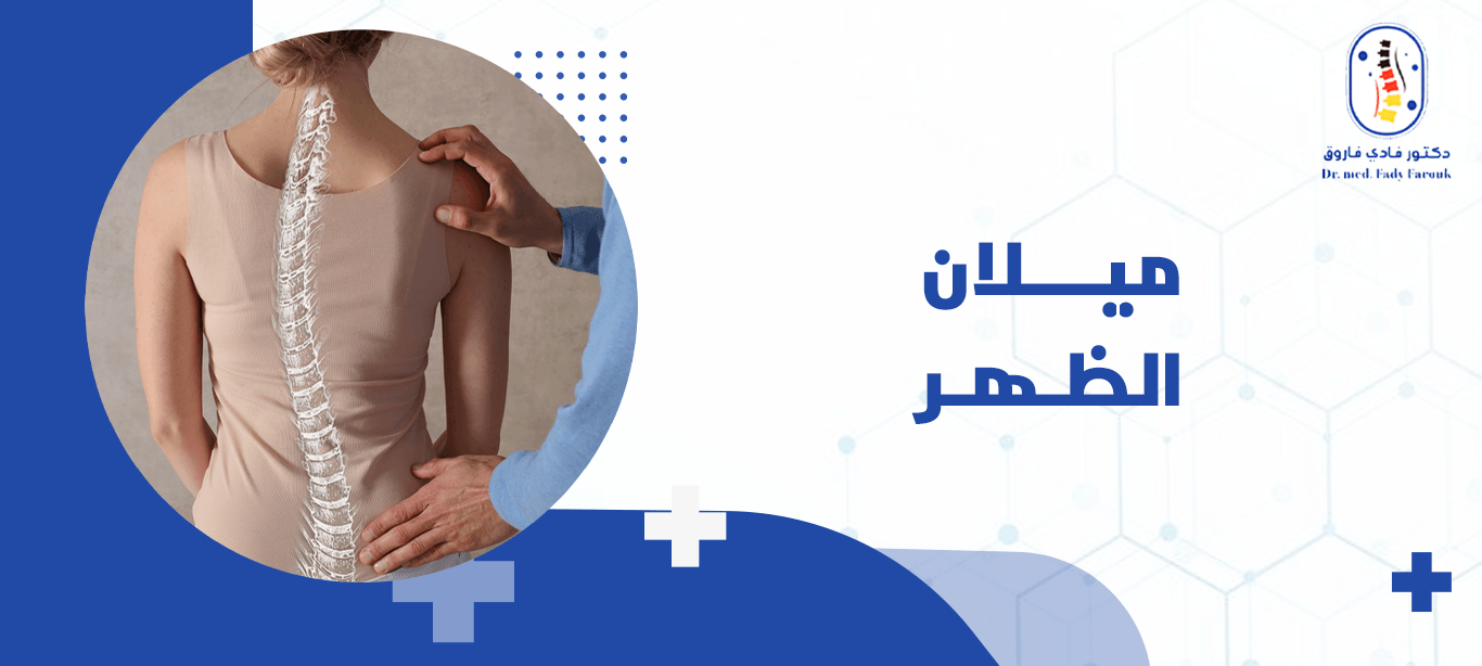 ميلان الظهر