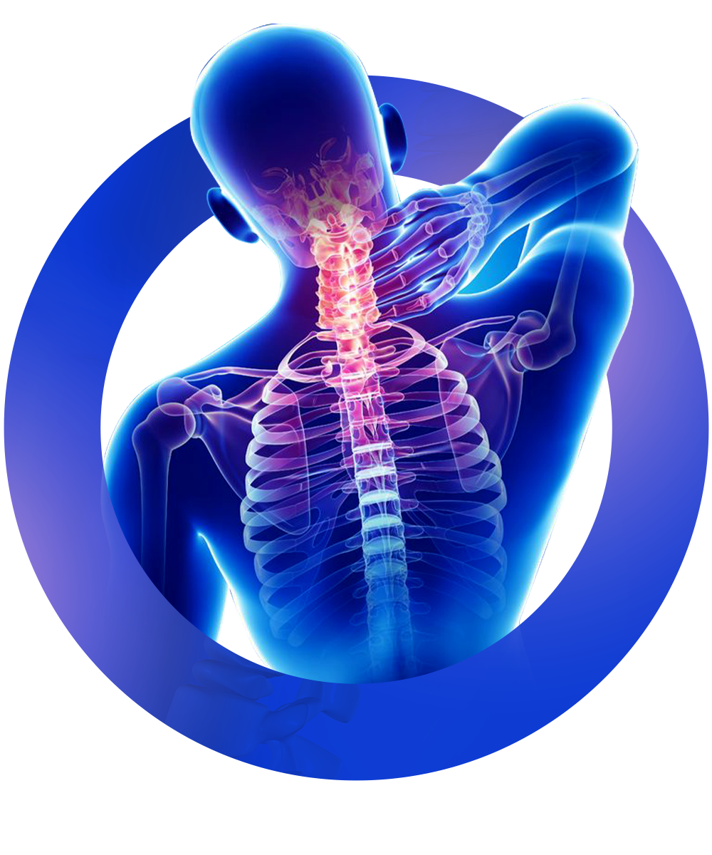 علاج ضغط القناة العصبية العنقية