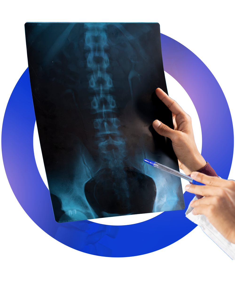 العلاج التحفّظي لآلام العمود الفقري